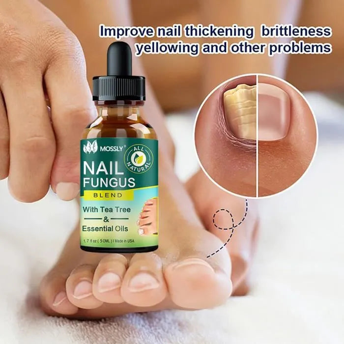 NAIL GROWTH & REPAIR SERUM (BUY 1 GET 1 FREE) (PACK OF 2)