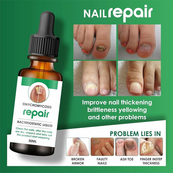 NAIL GROWTH & REPAIR SERUM (BUY 1 GET 1 FREE) (PACK OF 2)